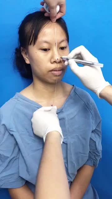 Trước khi phẫu thuật chỉnh hình hàm mặt cần làm gì?