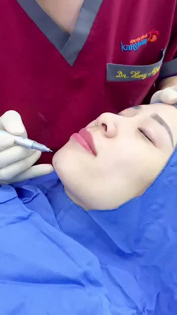 Cận cảnh bác sĩ "thiết kế" dáng cằm V-line khắc phục CẰM NGẮN-LẸM