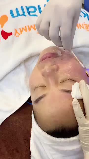 TRẺ HÓA DA - Công nghệ mới TEMPSURE ENVI