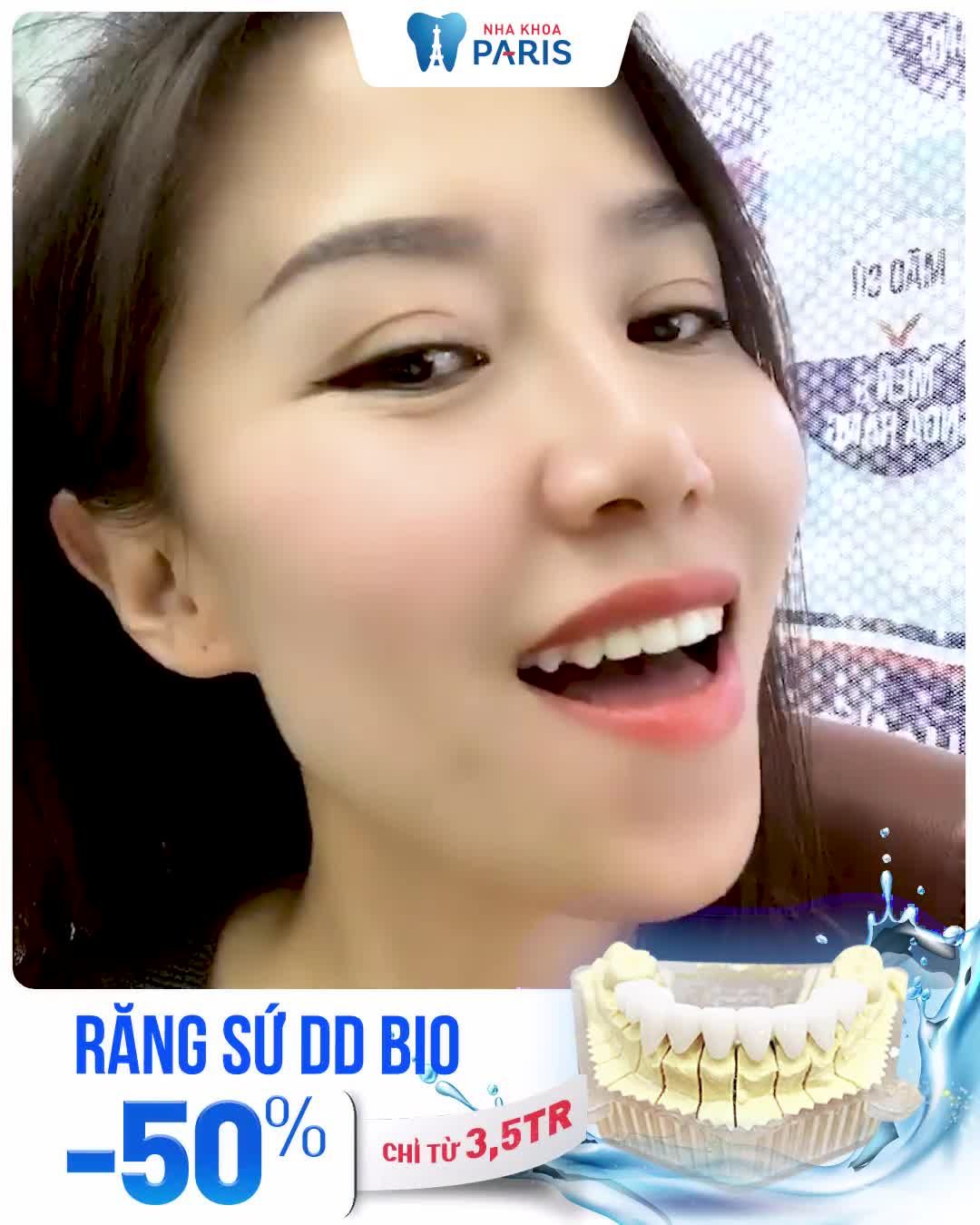 2 Ngày Bọc Răng Sứ - Răng Đẹp Toàn Diện