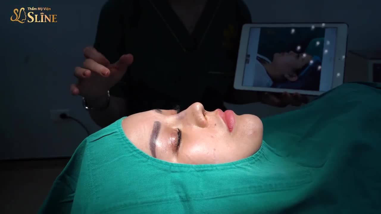 GIẢI CỨU  MŨI HỎNG SAU NÂNG