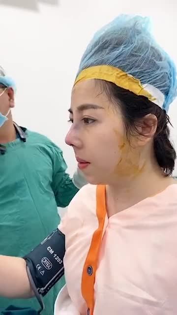 Livestream khách hàng sóng mũi thấp, đầu mũi ngắn hếch, sóng mũi gồ, đầu mũi to, cánh mũi bè