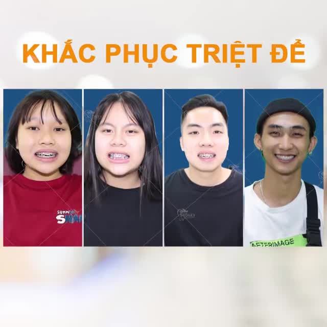 NIỀNG RĂNG MẮC CÀI TRỌN GÓI CHỈ TỪ 16TR