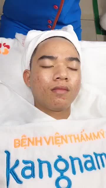 Nano skin - Kẻ thù của mụn ẩn, mụn bọc, mụn viêm,...