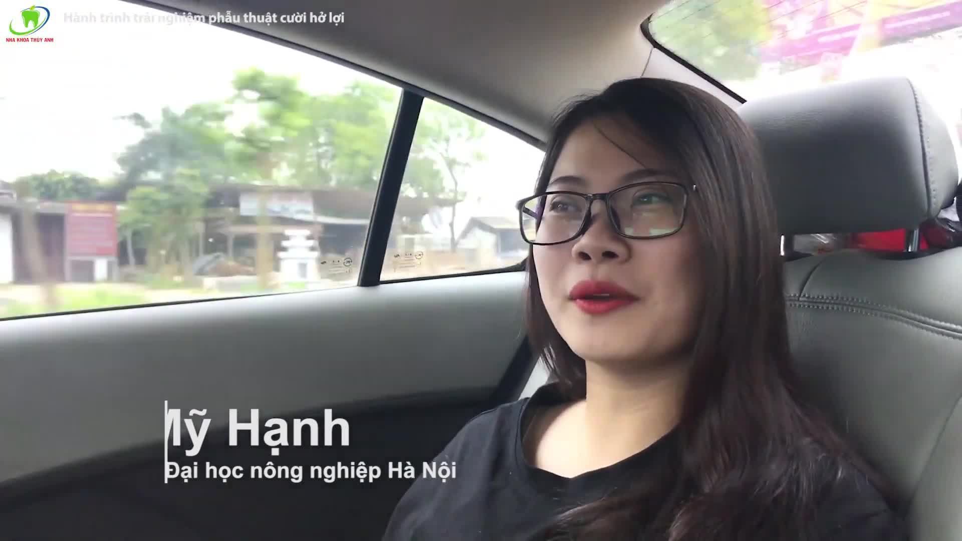 Cười hở lợi là tình trạng lợi bị lộ ra khi cười khoảng 3mm trở lên.