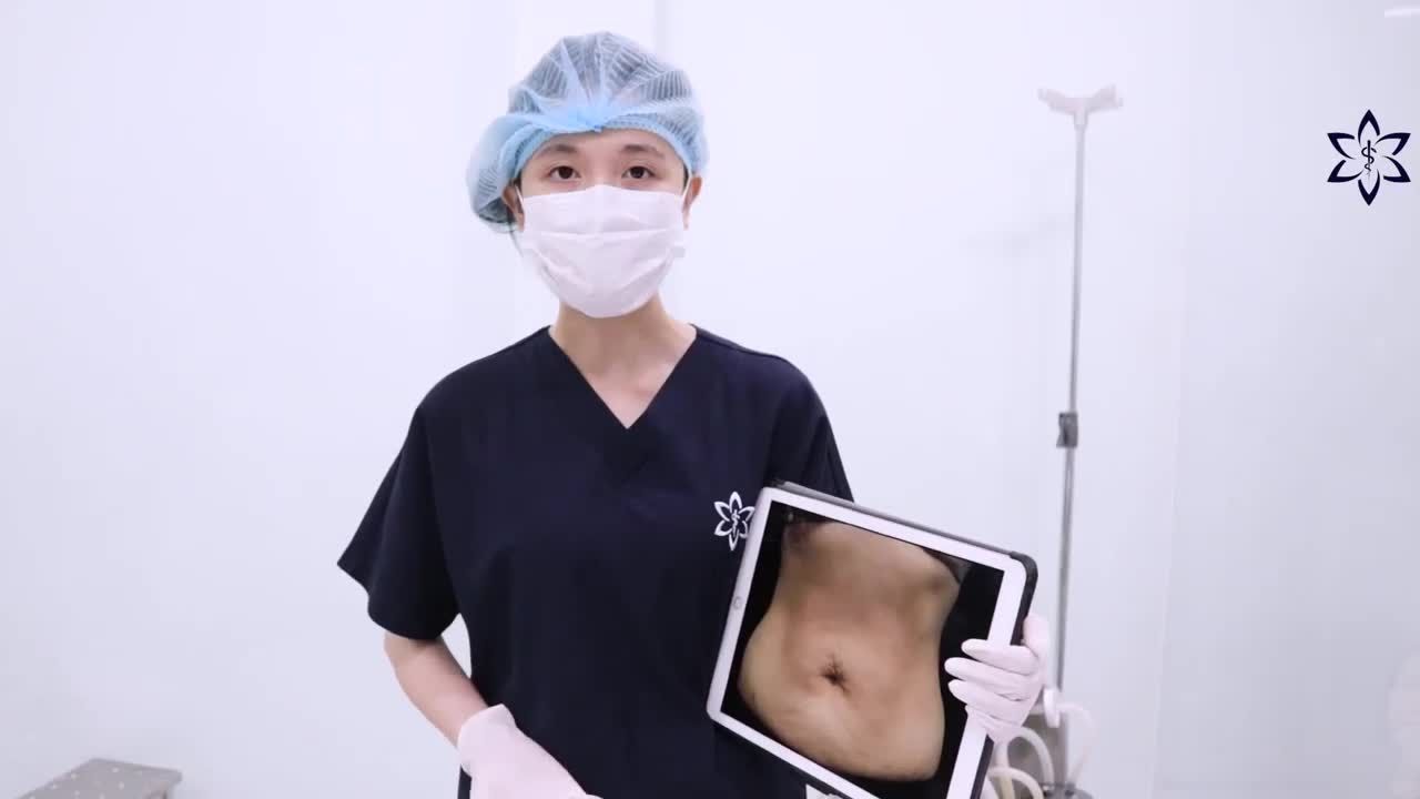 KHÁCH HÀNG ĐÃ SINH CON VÀ CÓ NHIỀU DA CHÙNG THÌ ĐÂU LÀ GIẢI PHÁP TỐI ƯU