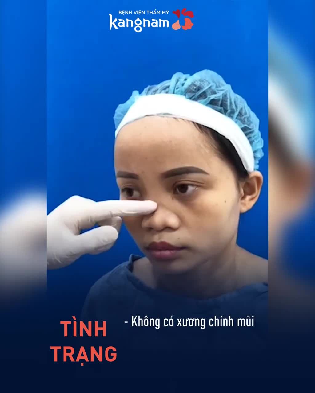 MŨI KHÔNG SỐNG và hành trình giải cứu thành công