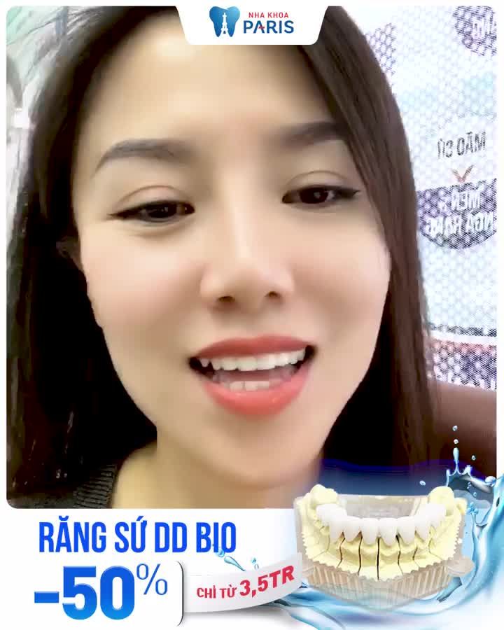 BỌC RĂNG SỨ -  Siêu Mỏng - Không Mài Nhỏ