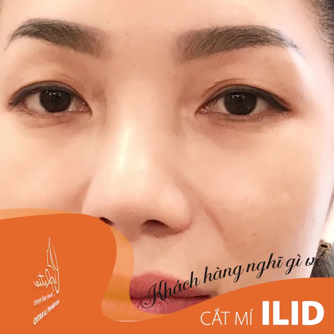 BIẾT TRƯỚC CẮT MẮT XONG ĐẸP VẬY THÌ SAO PHẢI ĐỢI CHỜ, ĐẮN ĐO ĐÚNG KHÔNG Ạ