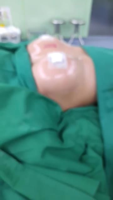 NÂNG NGỰC NỘI SOI CHÂN KHÔNG TẠI BÁC SĨ KỲ Y DƯỢC Thay đổi ngoạn mục sau 45 phút