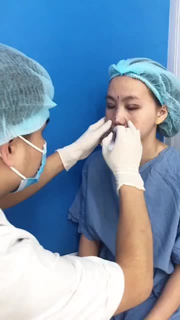Cùng bác sĩ Kangnam lên kế hoạch và thiết kế cho khách hàng làm trượt cằm bằng phương pháp ghép sụn tự thân.