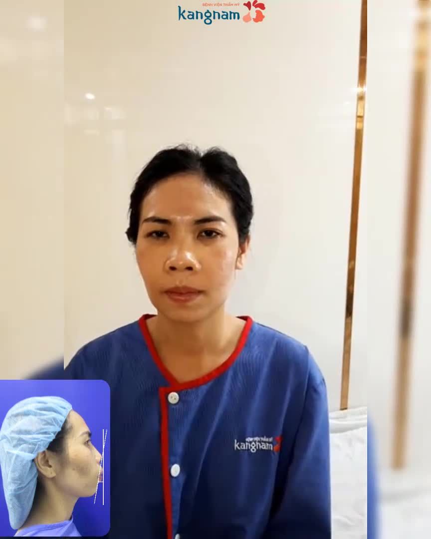 HÔ nặng, ảnh hưởng đến ăn nhai - 2 ngày thay đổi quá "ngoạn mục"