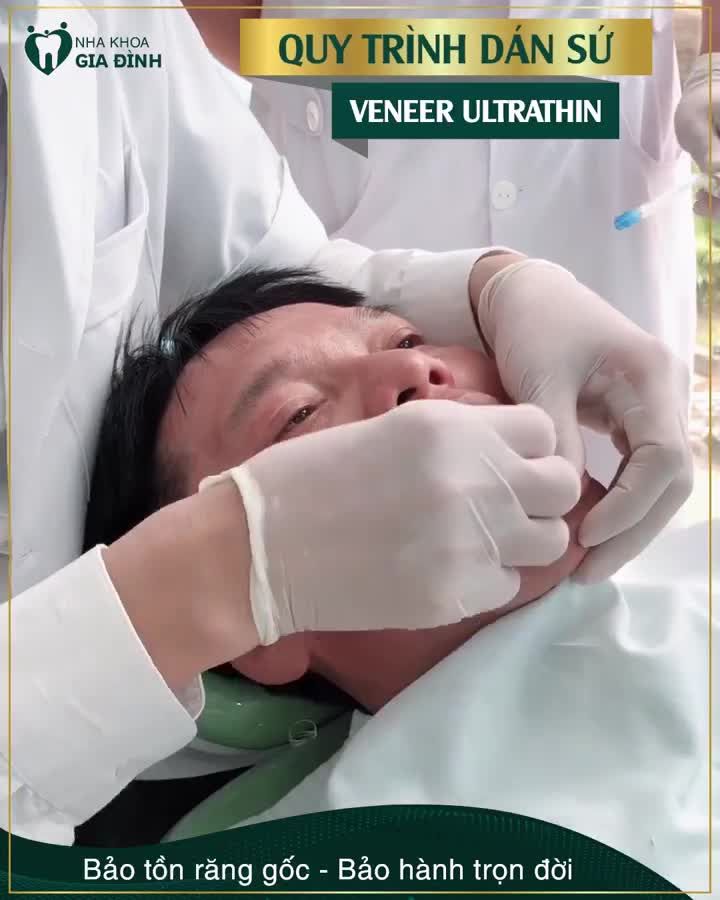 DÁN SỨ VENEER: TRẮNG TRONG TỰ NHIÊN – BẢO TỒN RĂNG GỐC
