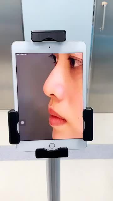 HOÀN THÀNH CA MŨI NGÀY THỨ 7 TRONG NGÀY