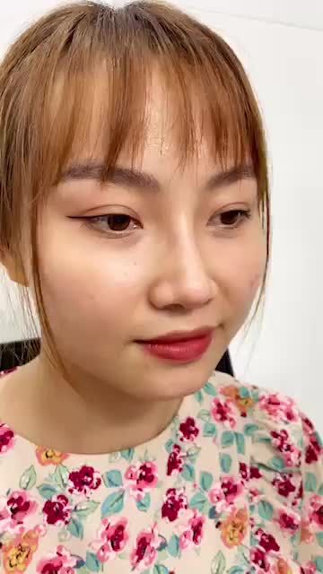 Mũi đẹp tự nhiên sau khi nâng mũi tại Kangnam - nâng mũi cấu trúc 4D mang lại kết quả đẹp bất ngờ