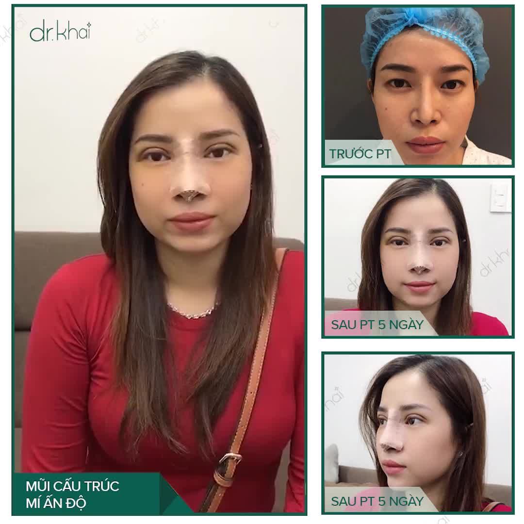 COMBO DỊCH VỤ CẮT MÍ ẤN ĐỘ + MŨI CẤU TRÚC SỬA LẠI