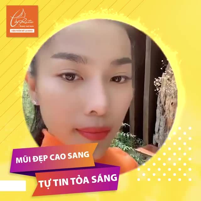 MŨI ĐẸP CAO SANG – TỰ TIN TỎA SÁNG