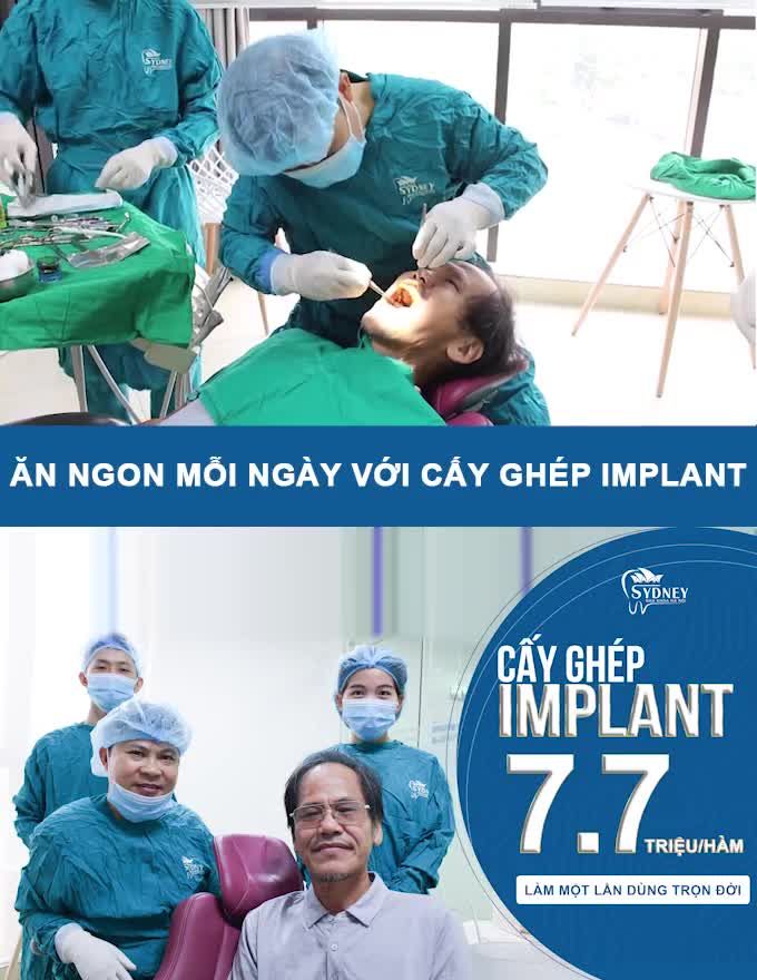 TẠI SAO CẤY CHÉP IMPLANT LẠI CÓ GIÁ CAO