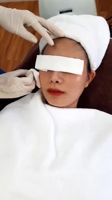 Quy trình chiếu ánh sáng ella sau khi lấy nhân mụn giúp da trắng sáng, giảm sưng đỏ, kích thích sự tăng trưởng collagen trong trị mụn Nano Skin