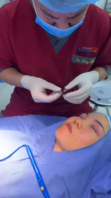 Quy trình thực hiện phẫu thuật combo nâng mũi - cắt mí tại BVTM KANGNAM