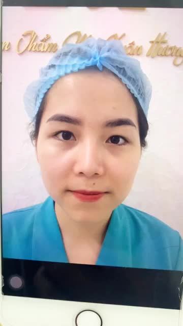 MÍ ĐẸP NGAY SAU 15 PHÚT NHẤN MÍ EYELID PLUS TẠI TMV XUÂN HƯƠNG