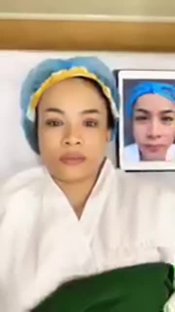 Thêm một ca cắt mí trên vừa hoàn thành