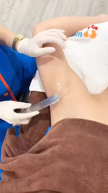 Quy trình triệt  lông nách vĩnh viễn tại bvtm Kangnam - lông nách cải thiện 100% sau liệu trình