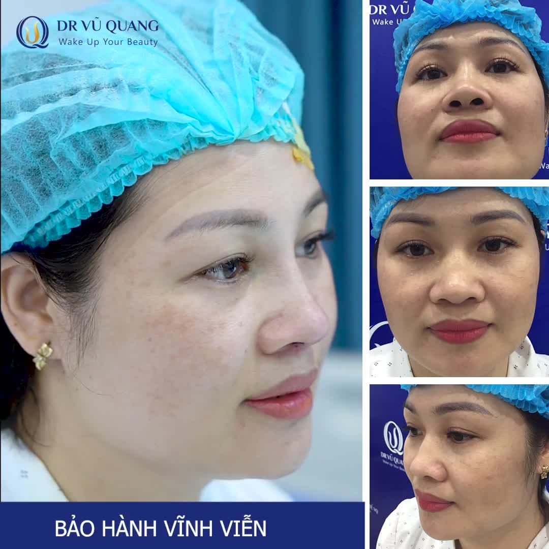 Khách hàng nâng mũi Softline tại VQ.