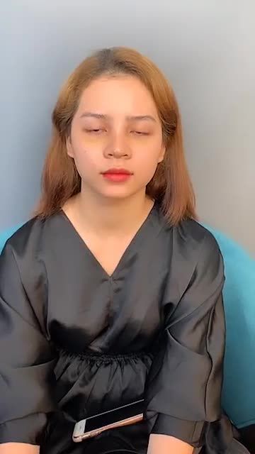 NÂNG MŨI BỌC SỤN DÁNG BAY TRUNG HOA