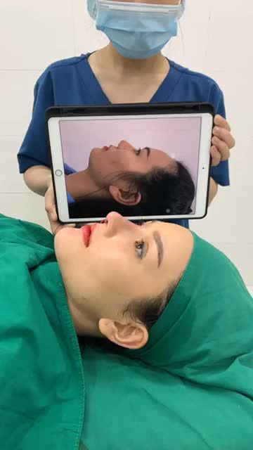 Nâng mũi cấu Trúc sửa lại Kết hợp độn cằm...!