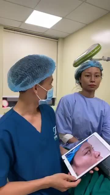 NÂNG MŨI S-Line - THU GỌN CÁNH MŨI