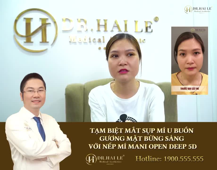 "Cảm ơn đội ngũ bác sĩ Dr.Hải Lê đã giúp em có một đôi mắt để em tự tin hơn". - Tuyết Anh vị khách hàng đã trở nên xinh hơn, tươi hơn với kết quả cắt mí Mani Mini Deep 5D.