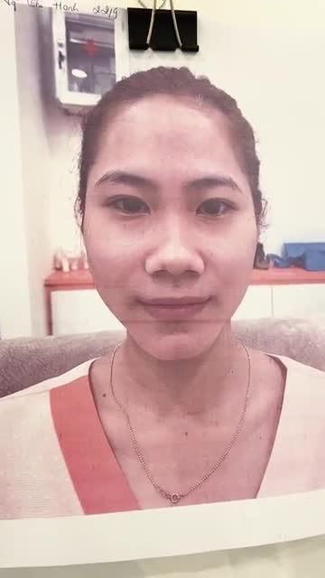 Mũi to bè - khuyết điểm không của riêng ai