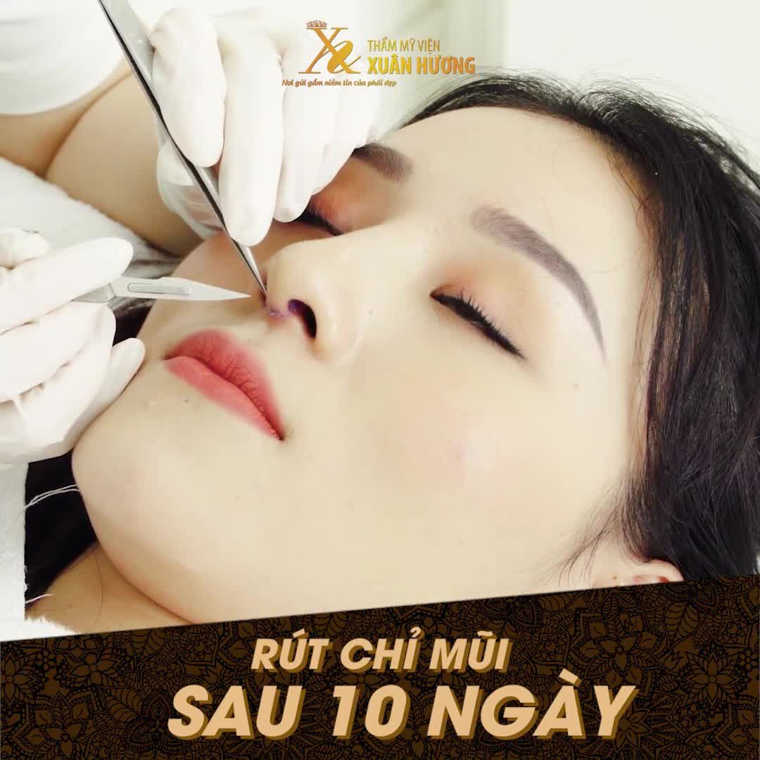 THỰC HƯ TƯỚNG MŨI GỒ Ở PHỤ NỮ - TỐT HAY KHÔNG TỐT?