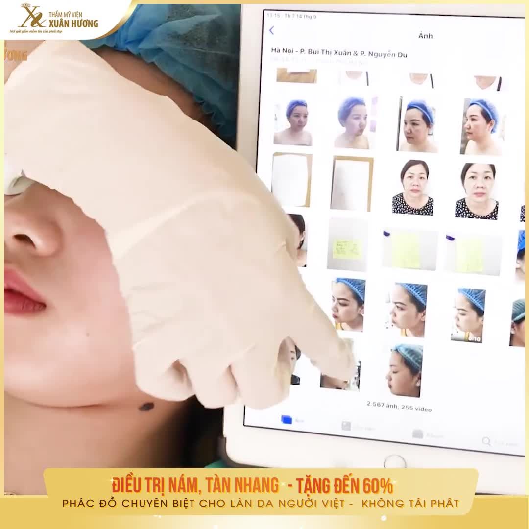 ĐUỔI XA NÁM  ĐÁNH BẬT TÀN NHANG DA SÁNG MỊN THẾ CHỖ CHO NÀNG TỰ TIN MỌI KHUNG HÌNH
