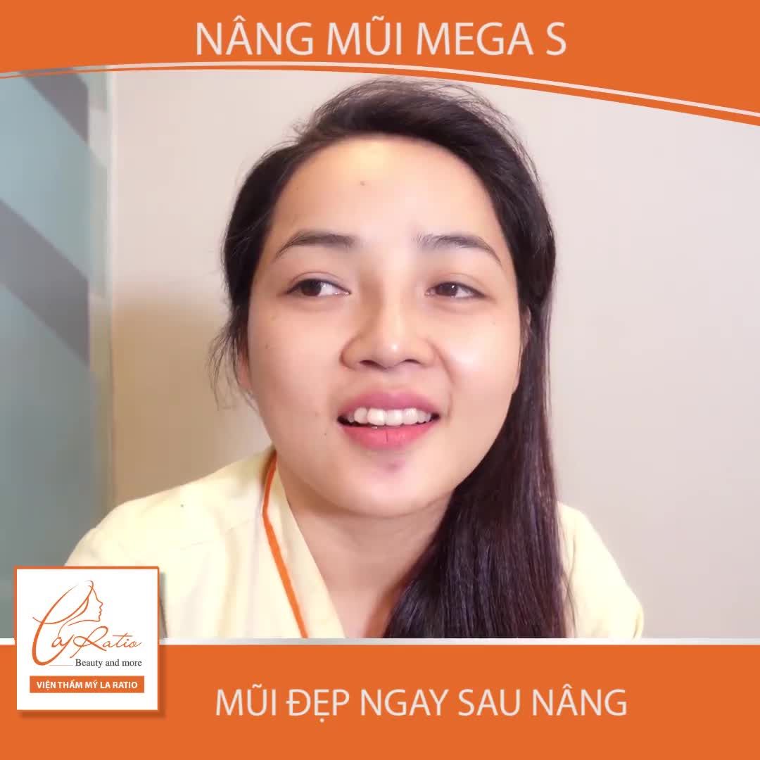 NÂNG MŨI MEGA S: THAY ĐỔI LẬP TỨC - ĐẸP XINH VĨNH VIỄN