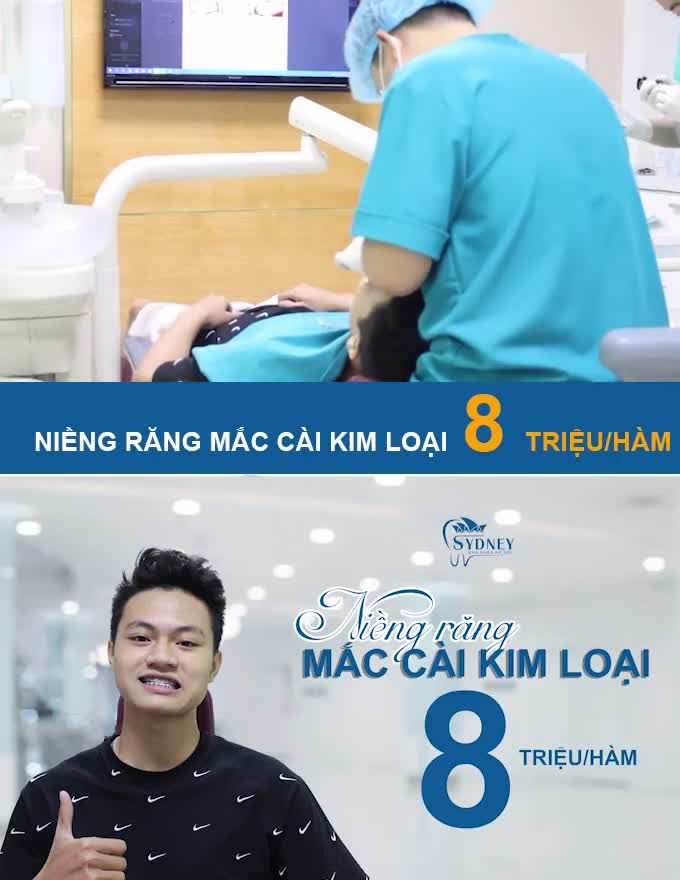 NẾU BẠN KHÔNG BIẾT CHỌN MẮC CÀI NÀO HÃY CHỌN MẮC CÀI KIM LOẠI