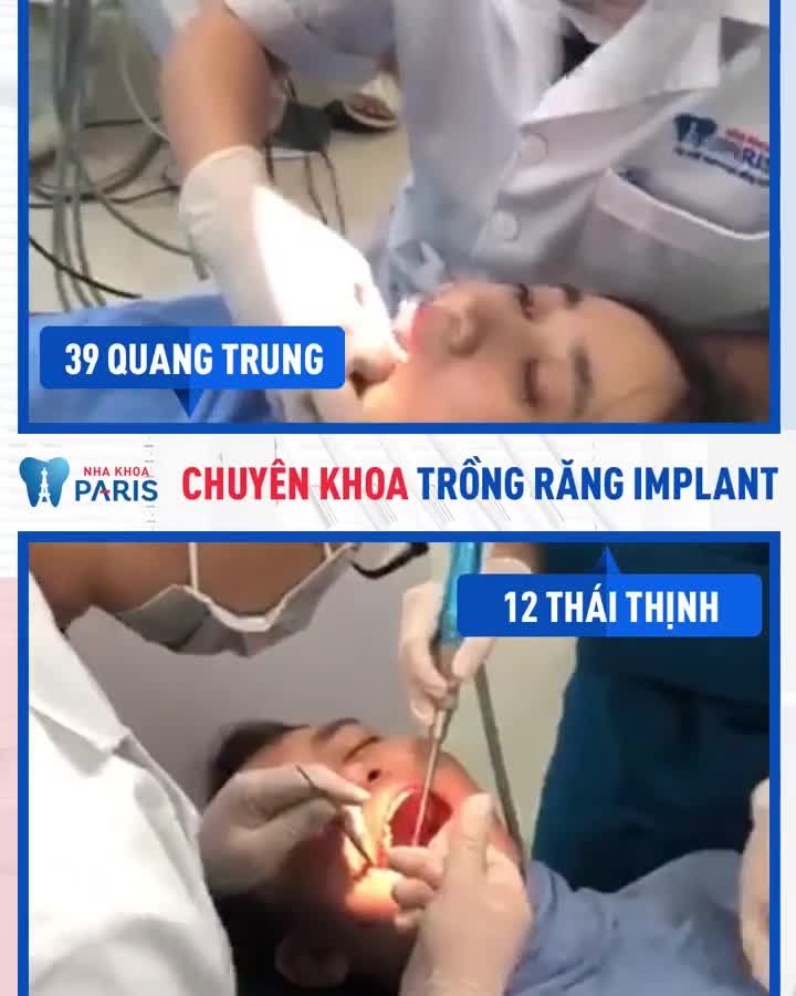 5 Ngày Khôi Phục Toàn Diện Răng Mất
