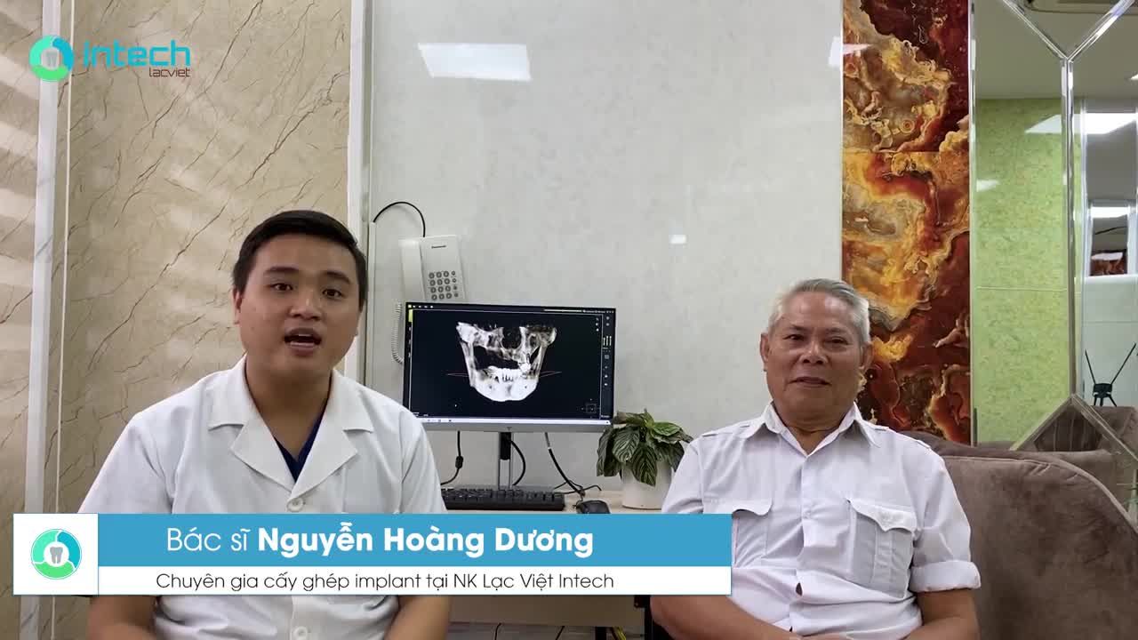 PHÂN TÍCH CẤY GHÉP RĂNG IMPLANT TOÀN HÀM ALL-ON-6