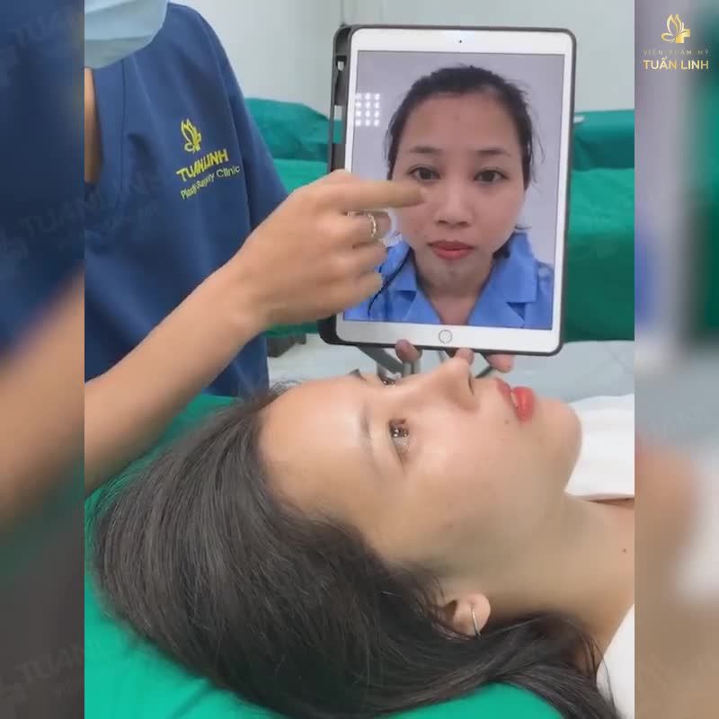 Các chị em " ?Ố? ?Ì?? ?Ị??" với xu hướng làm đẹp toàn diện  NÂNG MŨI kết hợp ĐỘN CẰM