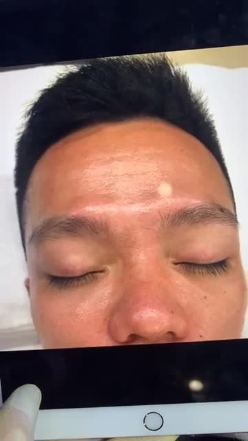 Điêu khắc lông mày Nam Tại kangnam Đẹp chuẩn "men" - không đau, không sưng, không tê bì