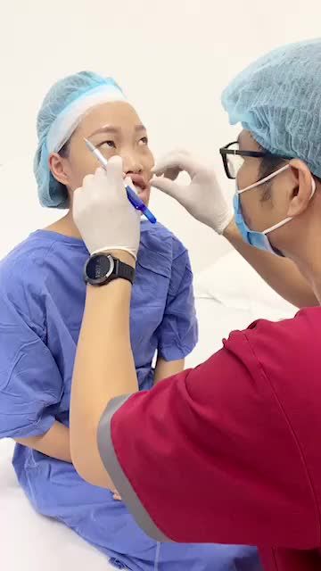Ca mặt khó Gãy tầng mặt giữa do tai nạn khiến lệch khớp cắn nặng