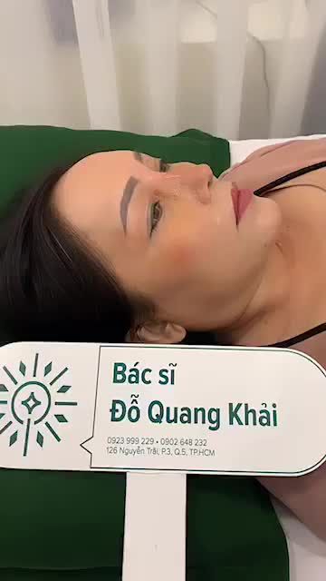 Ca nâng mũi cấu trúc cao tây kết hợp đục xương bè