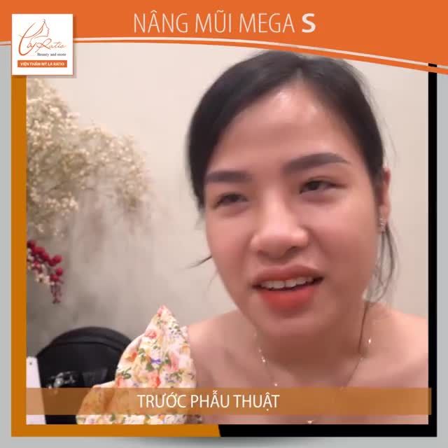 CHÍNH KHÁCH HÀNG NGHĨ GÌ SAU KHI VỪA THỰC HIỆN XONG DỊCH VỤ NÂNG MŨI MEGA S