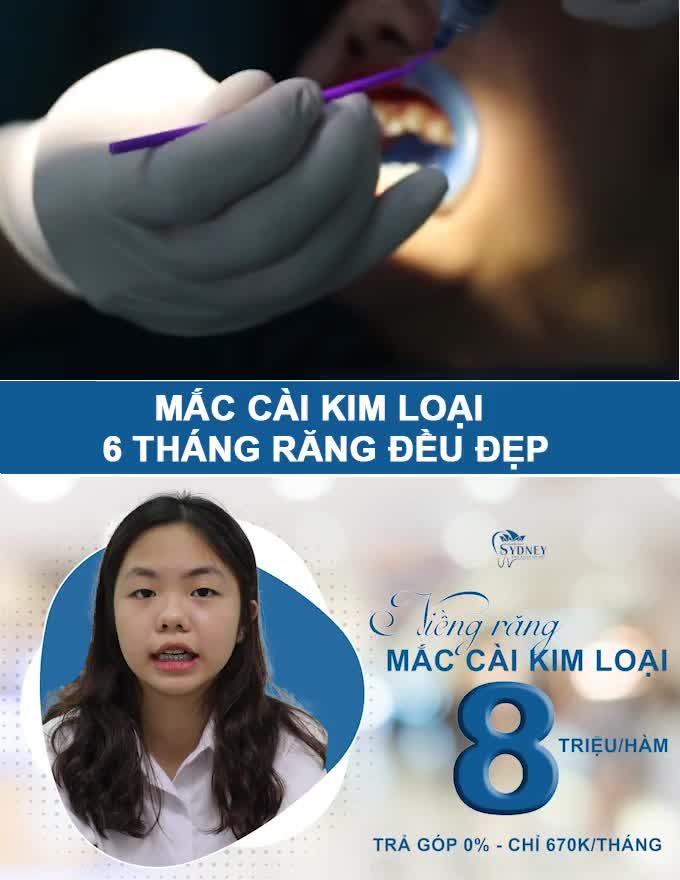 LÀM THẾ NÀO ĐỂ CẢI THIỆN RĂNG CỦA CON