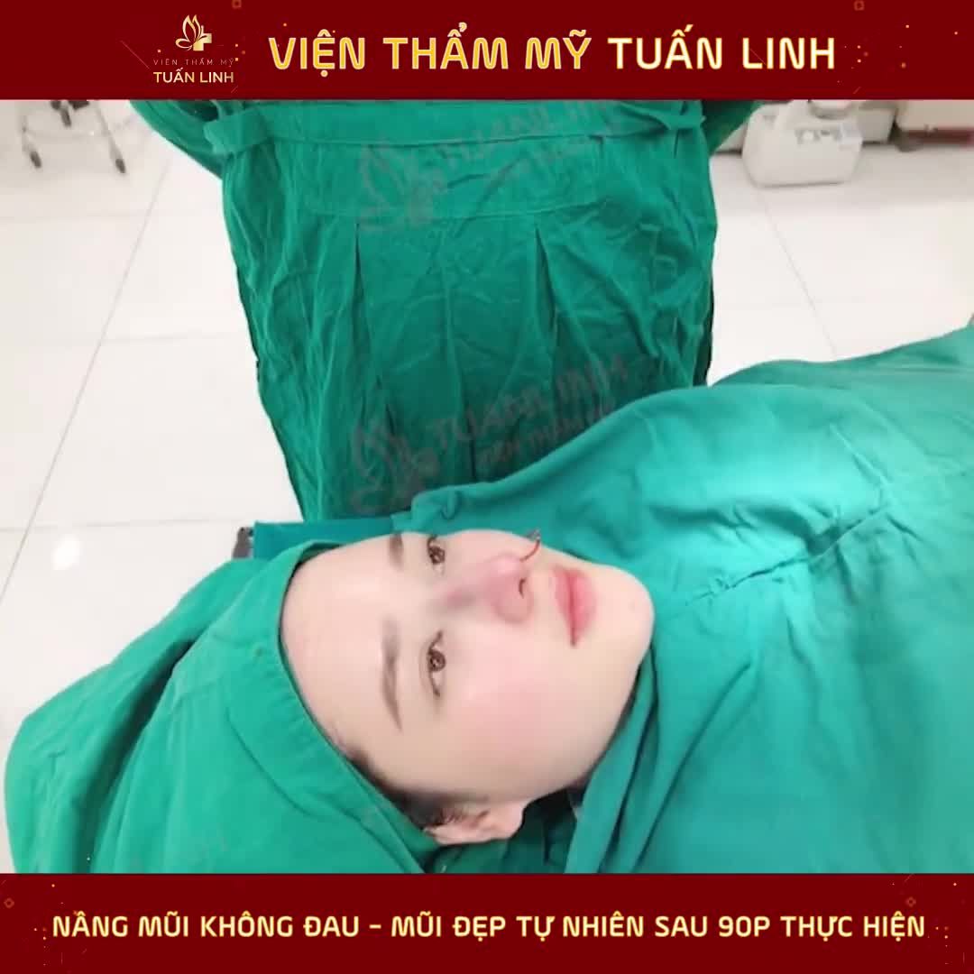 NÂNG MŨI CÓ ĐAU KHÔNG