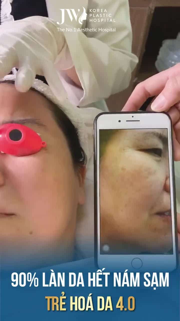 Tạm biệt sạm nám thâm sâu Tạm biệt đồi mồi nâu đen