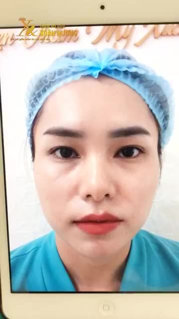 MÍ ĐẸP NGAY SAU KHI NHẤN MÍ TẠI TMV XUÂN HƯƠNG