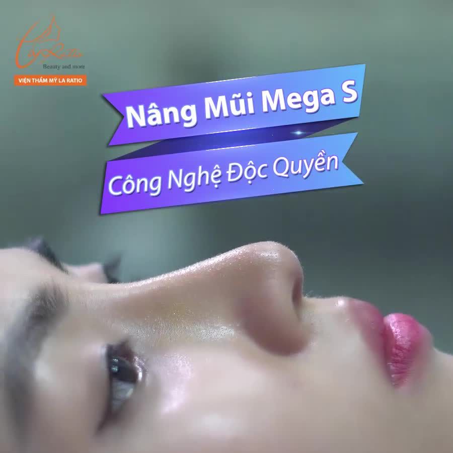 NÂNG MŨI MEGA S CÔNG NGHỆ ĐỘC QUYỀN