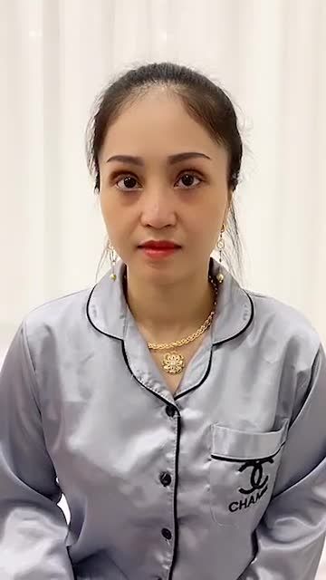 CA CẮT MÍ SAU 5 NGÀY